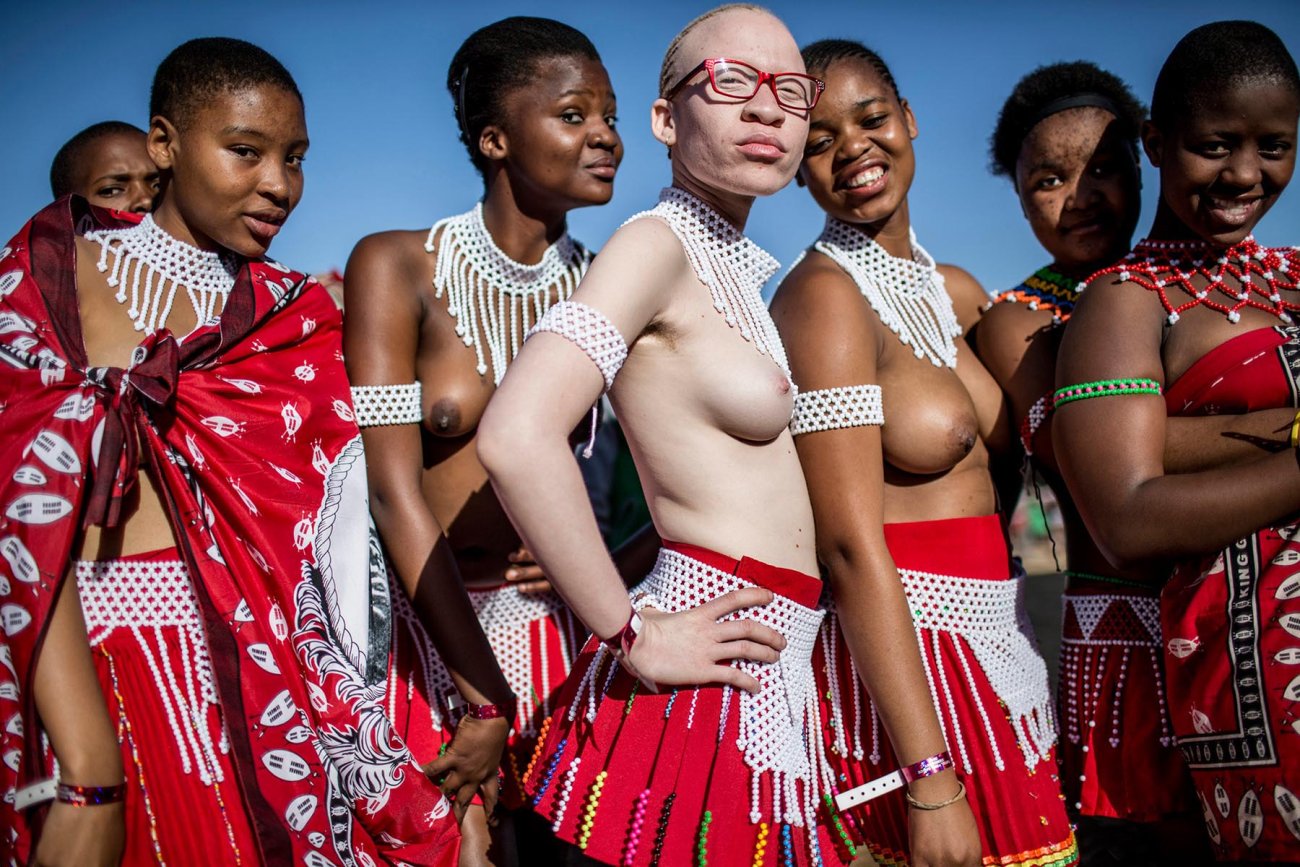 A South African albino posing with other girls for the now traditional Reed...